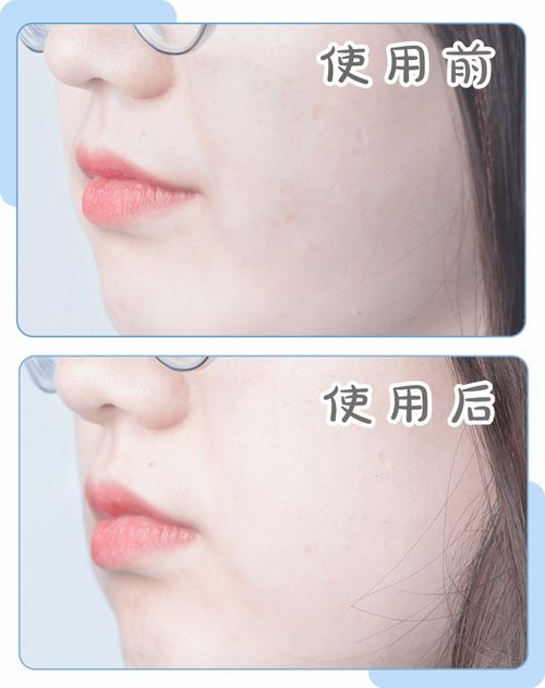 汽车下唇边修复的价格详解